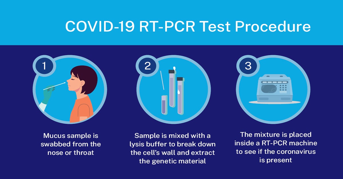 COVID PCR test